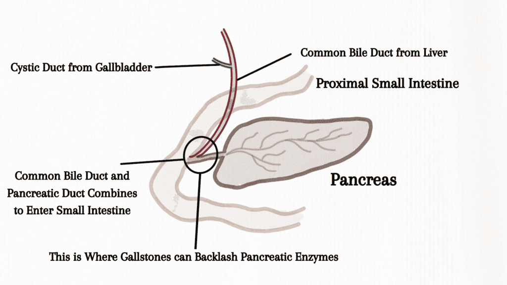 Pancreatic diseases lead to malabsorption.
