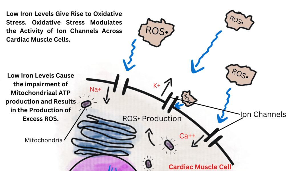 Low iron levels increase the chances of oxidative damage to the cardiac muscle cells, also causing disruptions in the ion channels